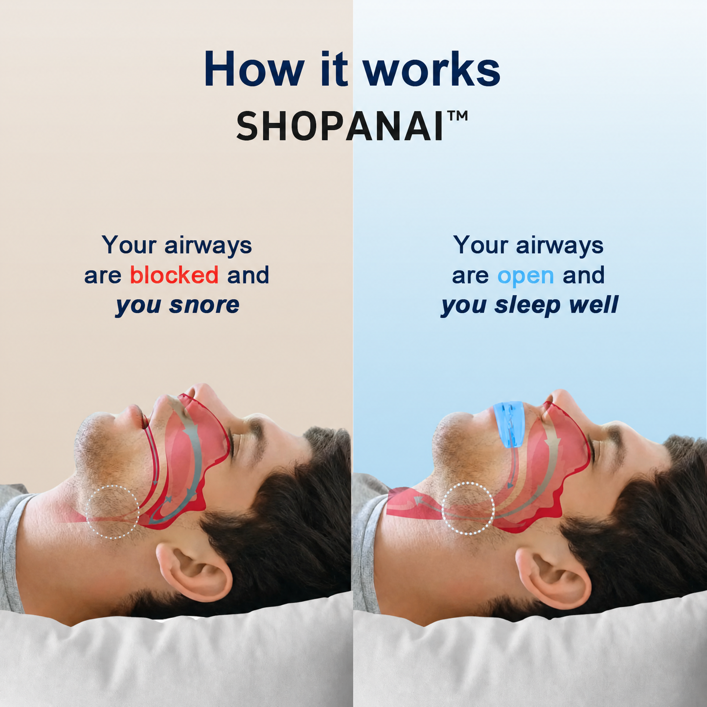 LVORNIX™  Professional intelligent anti-snoring device